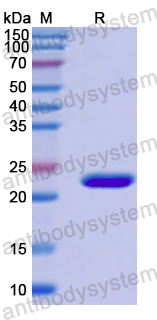 Recombinant Human TWIST1 Protein, N-His