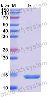 Recombinant Human KISS1 Protein, N-His