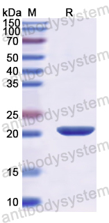 Recombinant Human MYLK Protein, N-His