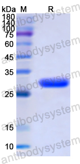 Recombinant Human TAB1 Protein, N-His