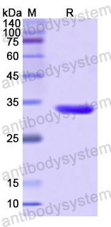 Recombinant Human MAPK11 Protein, N-His