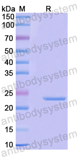 Recombinant Human EFNB3 Protein, N-His-SUMO