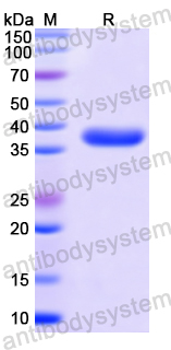 Recombinant Human SMAD2 Protein, N-His