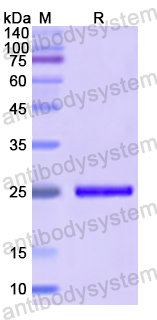 Recombinant Human SMAD1 Protein, N-His