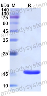 Recombinant Human CST6 Protein, N-His