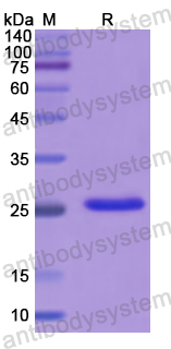 Recombinant Human Adiponectin/ACRP30/ADIPOQ Protein, N-His
