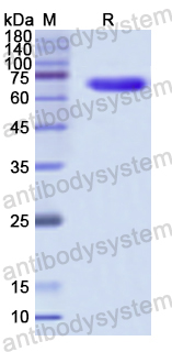 Recombinant Human EZH2 Protein, N-GST