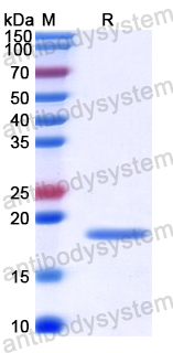 Recombinant Human EZH2 Protein, N-His