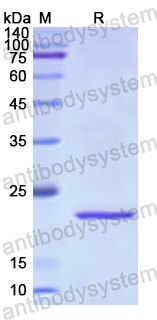Recombinant Human ZYX Protein, N-His