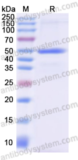 Recombinant Human ETFDH Protein, N-His