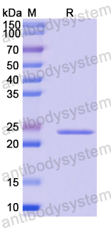Recombinant Human CCDC6 Protein, N-His-SUMO