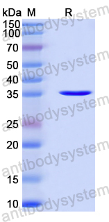 Recombinant Human E2F4 Protein, N-GST & C-His
