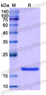 Recombinant Human IGFBP7 Protein, N-His