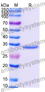 Recombinant Human PKN1 Protein, N-His