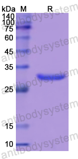 Recombinant Human PKN2 Protein, N-His