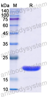 Recombinant Human TAF12 Protein, N-His