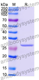 Recombinant Human CDC37 Protein, N-His