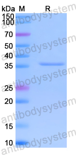 Recombinant Human RBBP7 Protein, N-His