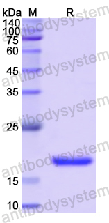 Recombinant Human FXN Protein, N-His
