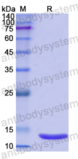Recombinant Human CALCRL Protein, N-His