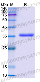 Recombinant Human ECM1 Protein, N-His