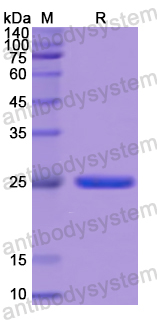 Recombinant Human AANAT Protein, N-His