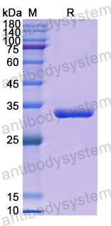 Recombinant Human SMN1 Protein, N-His