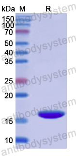 Recombinant Human Drebrin 1/DBN1 Protein, N-His