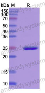 Recombinant Human MAPKAPK3 Protein, N-His