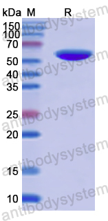 Recombinant Human PTGIS Protein, N-His