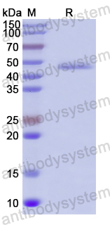 Recombinant Human PDK4 Protein, N-His