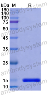 Recombinant Human FSCN1 Protein, N-His