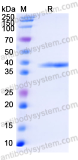 Recombinant Human MAPK6 Protein, N-His