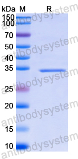 Recombinant Human CCL15/HCC-2/LKN-1/MIP-5 Protein, N-GST