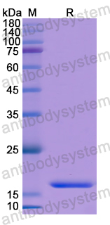 Recombinant Human DUSP5 Protein, N-His