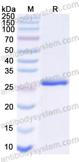Recombinant Human CLPP Protein, N-His