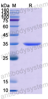 Recombinant Human TST Protein, N-His