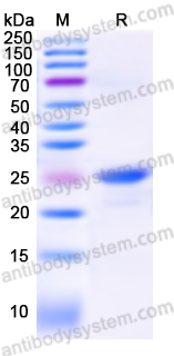 Recombinant Human UBE2S Protein, N-His