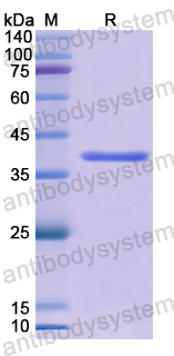 Recombinant Human QPCT Protein, N-His