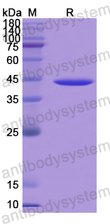 Recombinant Human KYAT1 Protein, N-His