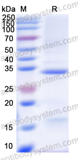 Recombinant Human LAMA3 Protein, N-His