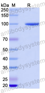 Recombinant Human LAMA3 Protein, N-His
