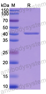 Recombinant Human CA9 Protein, N-His