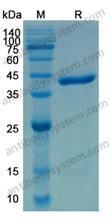 Recombinant Human PCK2 Protein, N-His