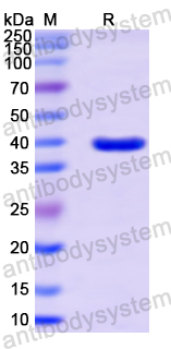 Recombinant Human DUSP6 Protein, N-His