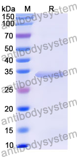Recombinant Human DUSP7 Protein, N-His