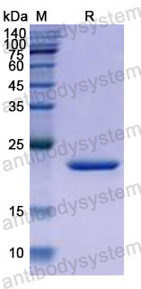Recombinant Human UPP1 Protein, N-His