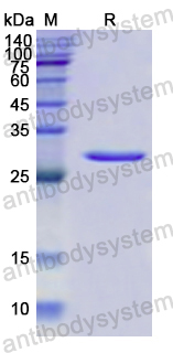 Recombinant Human HADH Protein, N-His