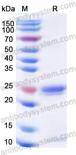 Recombinant Human CDO1 Protein, N-His