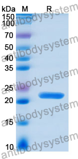 Recombinant Human TPD52L1 Protein, N-His